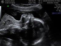 BABY_12.jpg