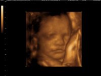 BABY GIRL DEBUSSCHERE_42.jpg