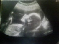 its a boy!.jpg