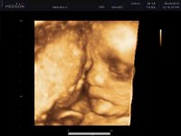 BABY_0027.jpg