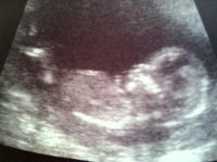 BabyF.jpg