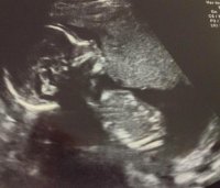 20week.jpg
