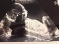 20weekscan.jpg
