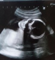 20+2 scan and 20+4 bump 004.jpg