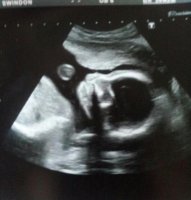 20+2 scan and 20+4 bump 005.jpg