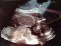 baby.jpg