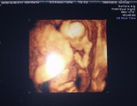 fingers in mouth (800x620).jpg