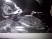 baby1.jpg