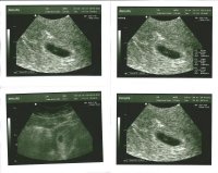 First Scan 8 Oct 2012.jpg