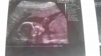 Baby S No2.jpg