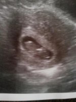 Baby 10 weeks 1 day oct 8 2012.jpg