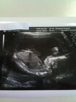 20 week scan 1.jpg