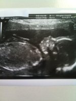 20 week scan 2.jpg
