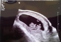 baby #2bnb.jpg