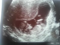 20121011_140005.jpg