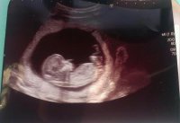 13 week scan.jpg