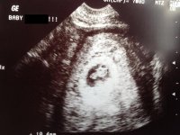 Baby's Second Picture.jpg