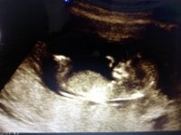 12 week baby.jpeg