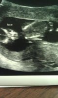 Baby face 12w3d oct 23 2012.jpg