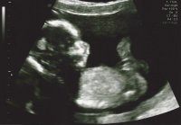 16 wk scan 2d.jpg