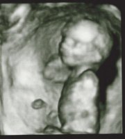 16 wk scan 3d.jpg