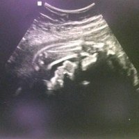 28weeks.jpg