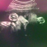 A28weeks.jpg