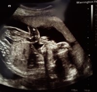 23wk-2days.jpg