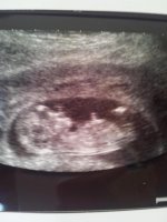 scan.jpg