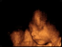 baby 3d echo 26 weeks.jpg