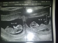 Twins..jpg
