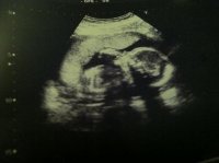 Caleb 20 weeks.jpg