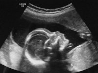 20wk profile.jpg