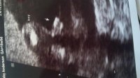 16 weeks its a boy.jpg