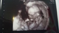 16 weeks 4d.jpg