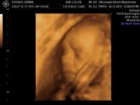 BABYBOND_5.jpg