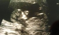 baby12weeks2.jpg