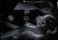 Bean 20wks4d.jpg