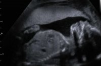 Bean 20wks4d 2.jpg