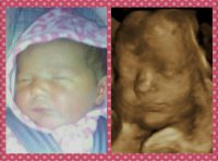 Lanay 3D 3 days old.jpg