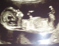 scan pic 13 w 2 days.jpg