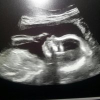 20 week scan.jpg