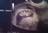 baby.jpg