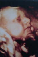 Braxton 31 weeks.jpg