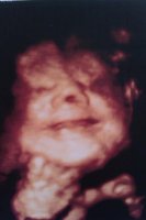 Braxton smiles 31 weeks.jpg