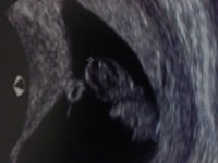 9wk scan.jpg