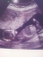 baby girl.jpg