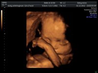 baby whittingham_2.jpg