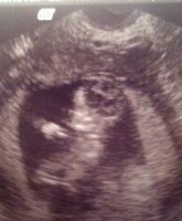 baby head.JPG