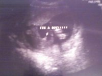 its a boy!.jpg